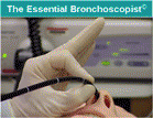 The Essential Bronchoscopist