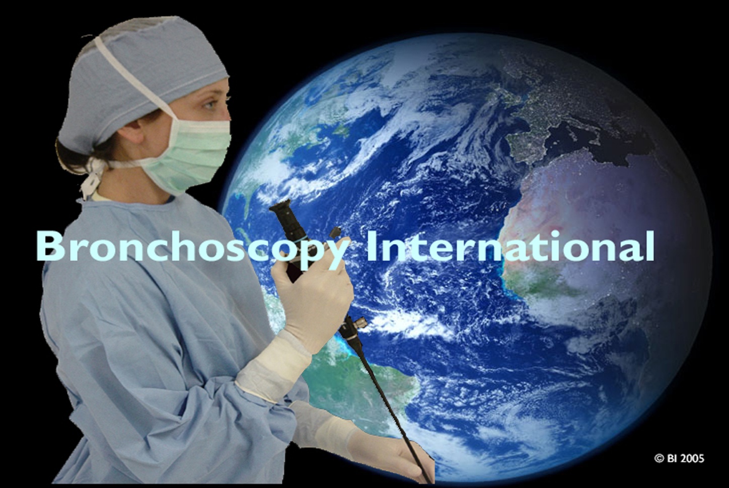 Rigid bronchoscopy with laser resection and stent for esophageal cancer